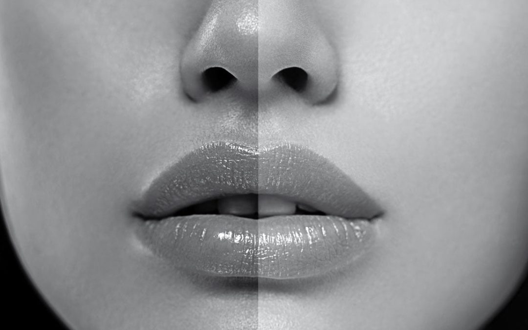 lift-sole-trattamenti-estetici-fondi-s