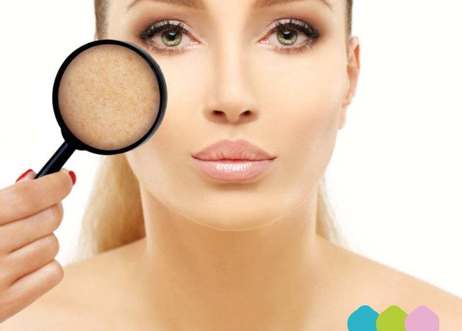 𝐒𝐎𝐒 𝐌𝐀𝐂𝐂𝐇𝐈𝐄 Se sul tuo viso è comparsa qualche antiestetica