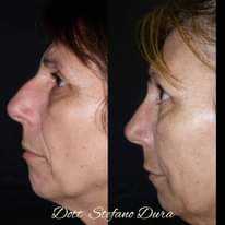 Potrebbe essere un'immagine raffigurante 2 persone e il seguente testo "Dott Stefano Dura"