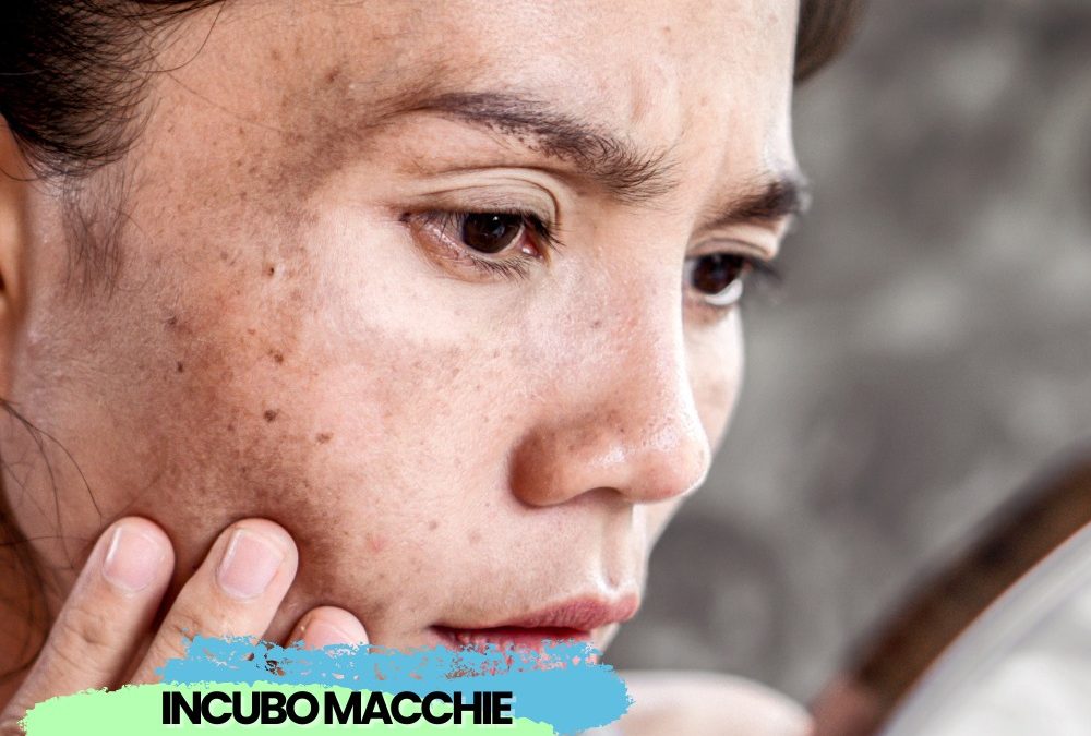 Le macchie scure sul viso richiedono un rituale skincare specifico e accurato pe…