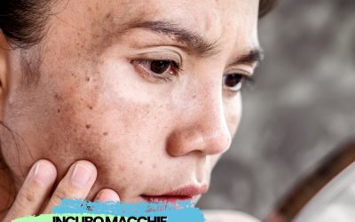 Le macchie scure sul viso richiedono un rituale skincare specifico e accurato pe…