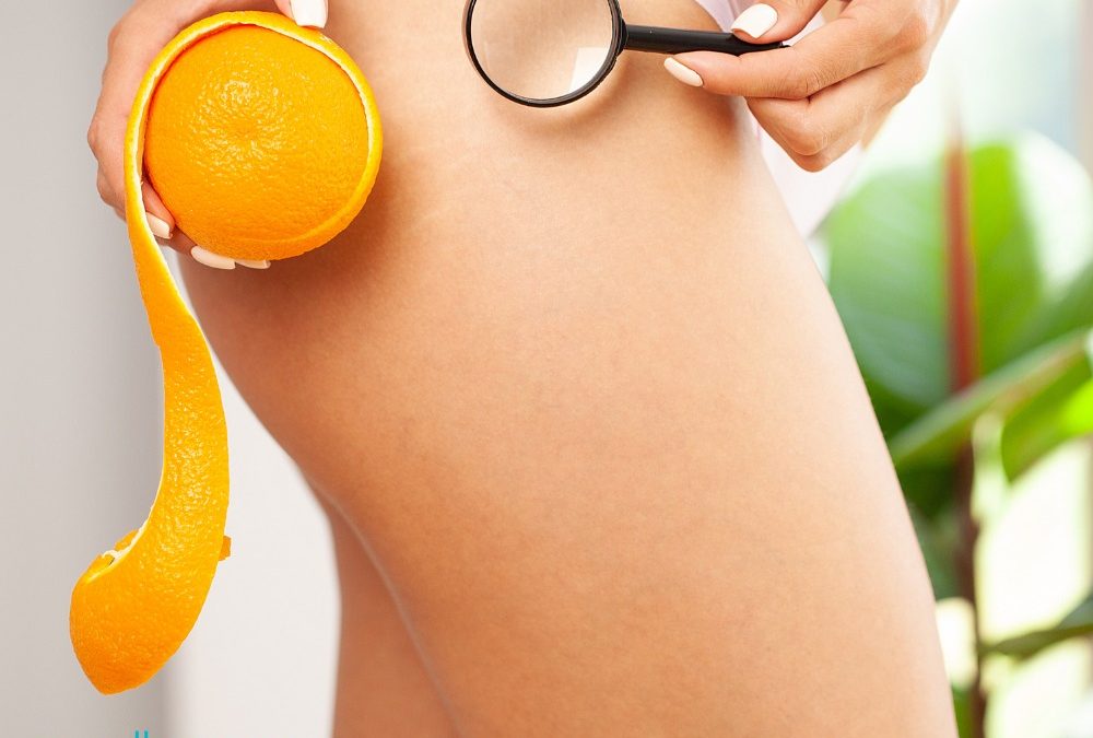 Quando si parla di cellulite, molte di noi si fanno prendere dallo sconforto per…