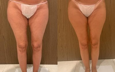 RISULTATI REALI, NON MAGIA! 
Guarda che trasformazione! 
Nessuna bacchetta magi…