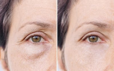 In tanti ci chiedete spiegazioni sul nostro trattamento viso AGE REVERSE MESOPEE…