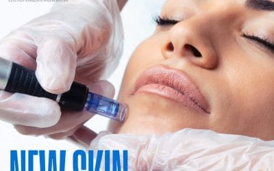 Un trattamento che parla il linguaggio della pelle.
Il Microneedling stimola i f…