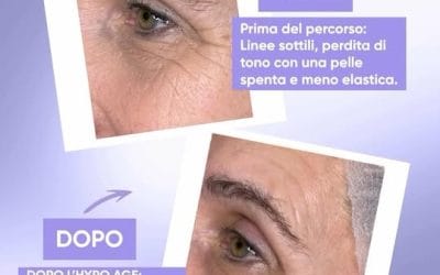 Oxygen Mesopeeling HYPO AGE – ringiovanente con effetto Botox-like immediato 
H…