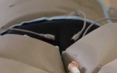 Gambe gonfie, pesanti o stanche
La pressoterapia di Wellness Suite –  Fondi (LT)…