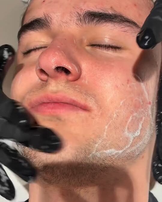 Il Mesopeeling all’ossigeno a tre strati è la nuova direzione innovativa della c…