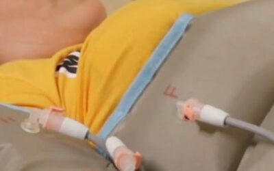 Il gonfiore addominale  è spesso legato a ristagni linfatici e cattiva circolazi…