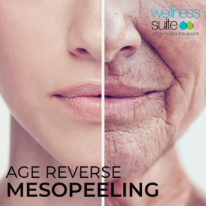 Trattamento Viso - AGE REVERSE MESOPEELING