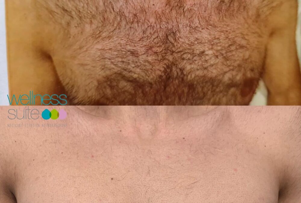 Questa estate fatti trovare pronto. Mostra i muscoli… non i peli.

Se stai già …