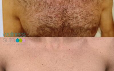 Questa estate fatti trovare pronto. Mostra i muscoli… non i peli.
Se stai già …