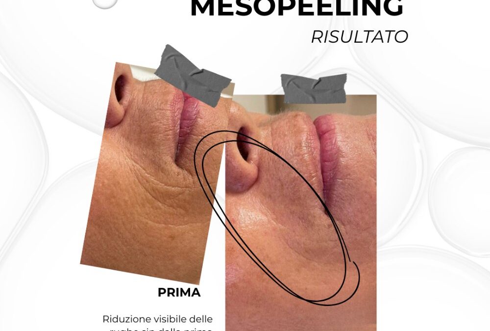 L’invecchiamento cutaneo parte dalle cellule.
Gli esosomi aiutano a “ripararle” …