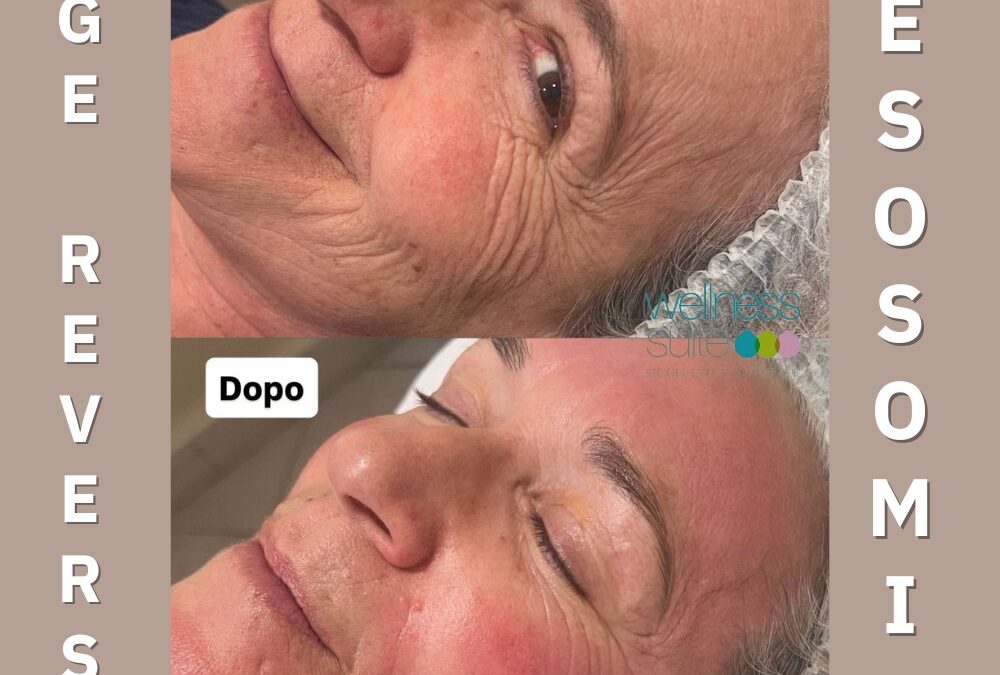 PRIMA il tempo che segna, DOPO la pelle che si rinnova…
Age Reverse ESOSOMI, i…