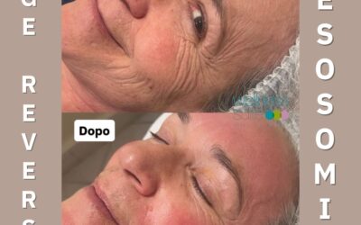 PRIMA il tempo che segna, DOPO la pelle che si rinnova…
Age Reverse ESOSOMI, i…