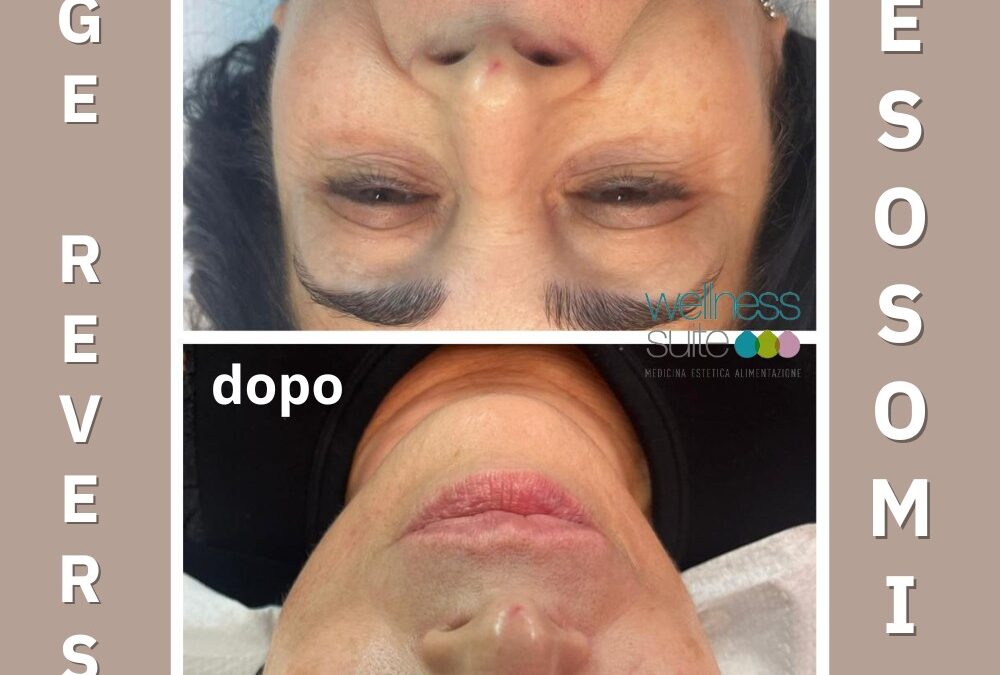 PRIMA segni evidenti, dOPO eleganza distesa…
E’ possibile!!!
Solo da Wellness …