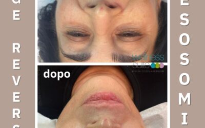 PRIMA segni evidenti, dOPO eleganza distesa…
E’ possibile!!!
Solo da Wellness …