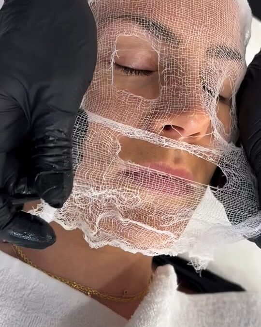 Problema Macchie? 
Mesopeeling Protocollo HY SPOTS (Oxygen Mesopeeling depigment…