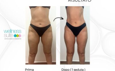 Vuoi vedere il tuo corpo cambiare già dalla prima seduta?
Prova CARBOXY senza ag…